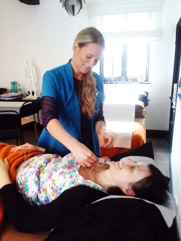 Lily Bayliss performing Acupuncture